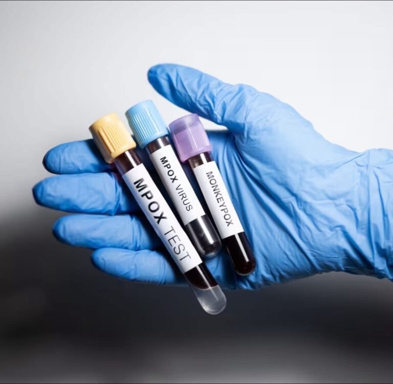 Yucatán confirma nuevos casos de Mpox y se mantiene como la segunda entidad con mayor incidencia en el país