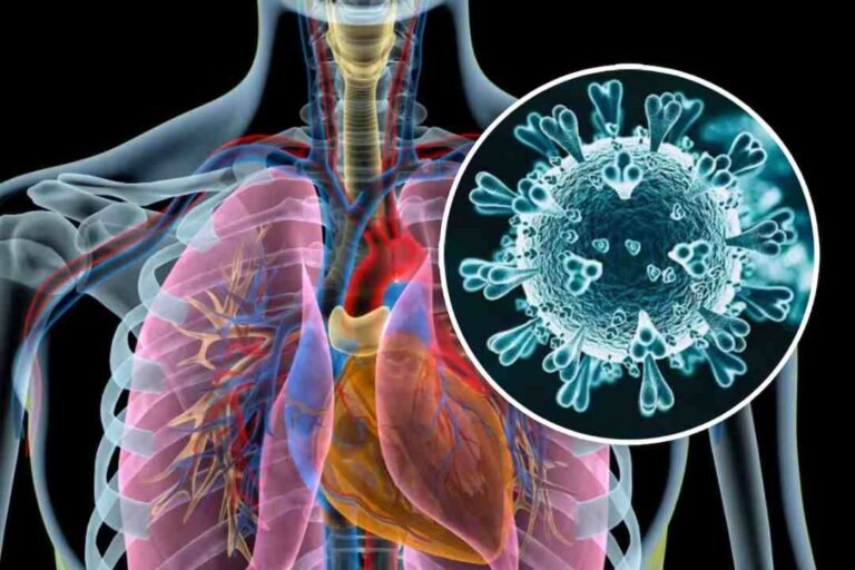 Alerta sanitaria en Yucatán: ¿Qué sabemos del Metapneumovirus?